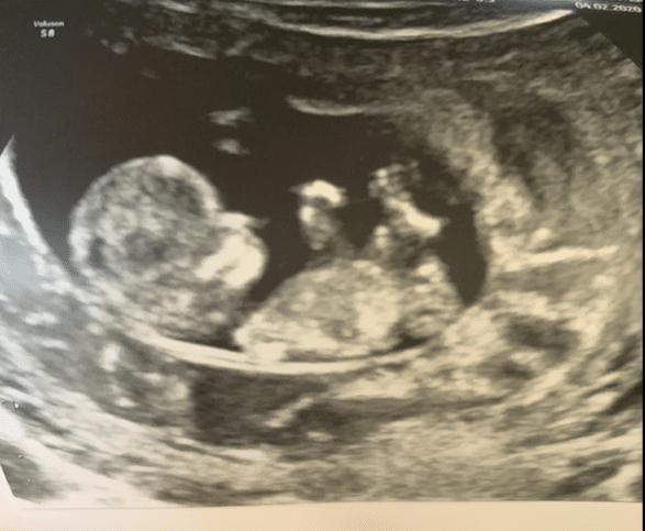 close up image of sonogram 