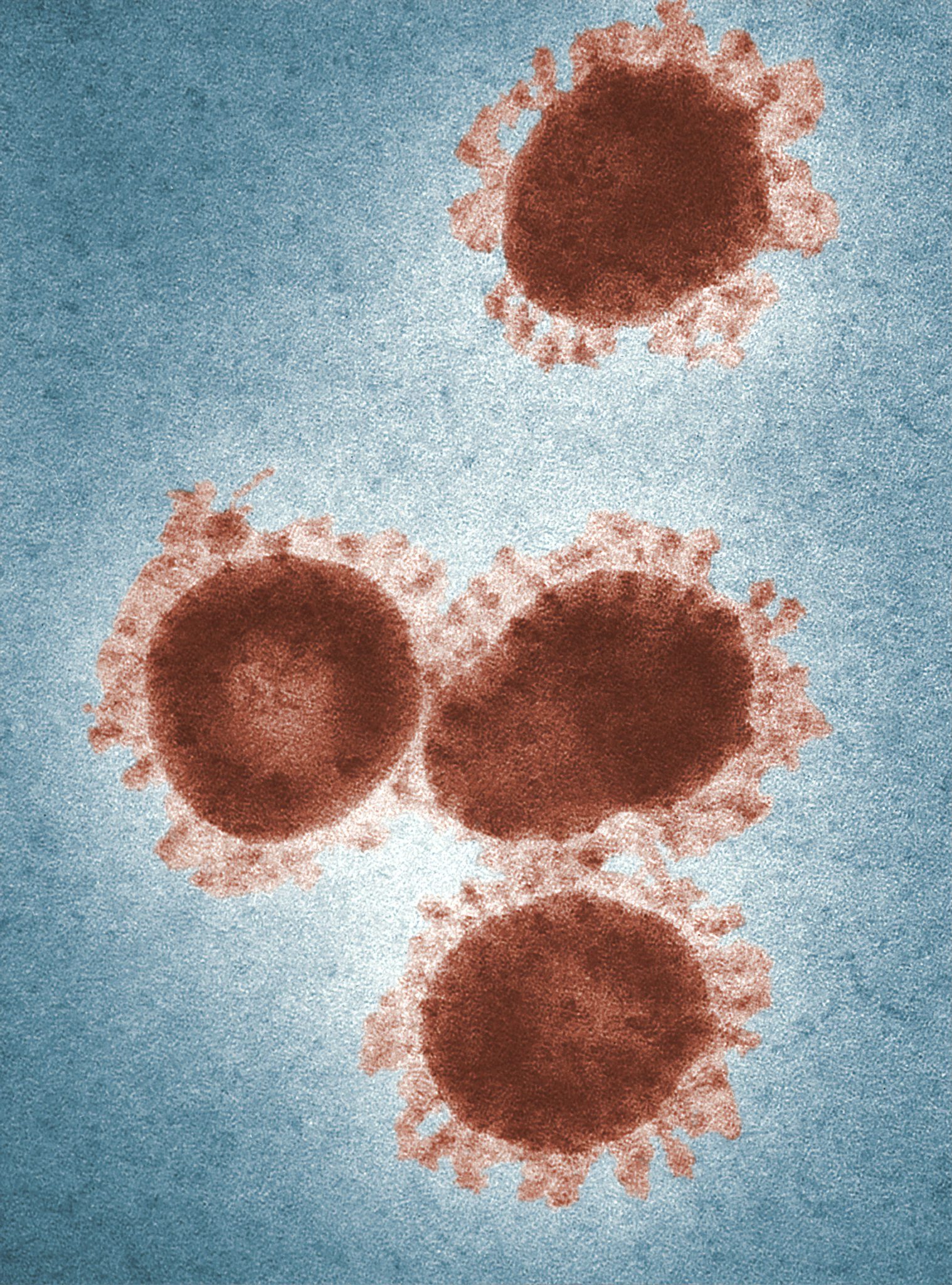 microscopic image of covid-19 virus 