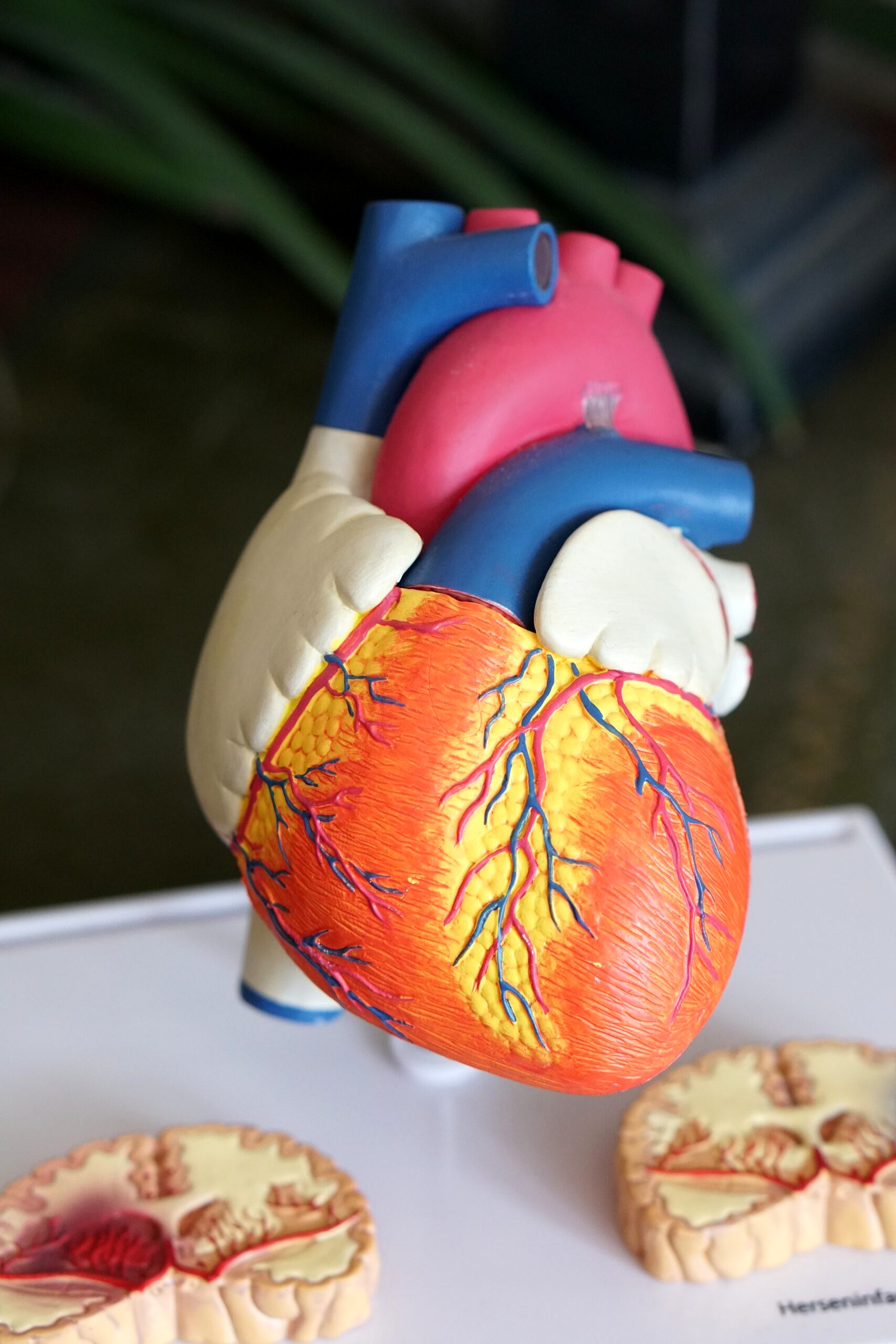 Model of a human heart.